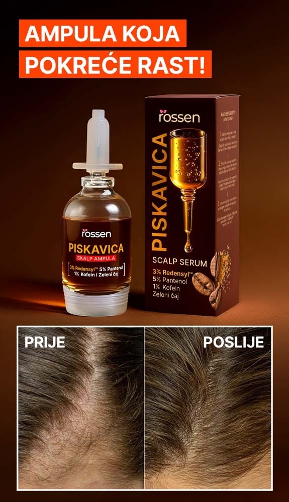 PISKAVICA-AMPULA---MOB---BIH